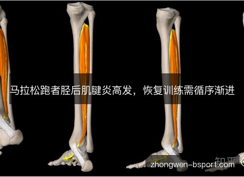 马拉松跑者胫后肌腱炎高发,恢复训练需循序渐进 马拉松跑者胫后肌腱炎高发,恢复训练需循序渐进